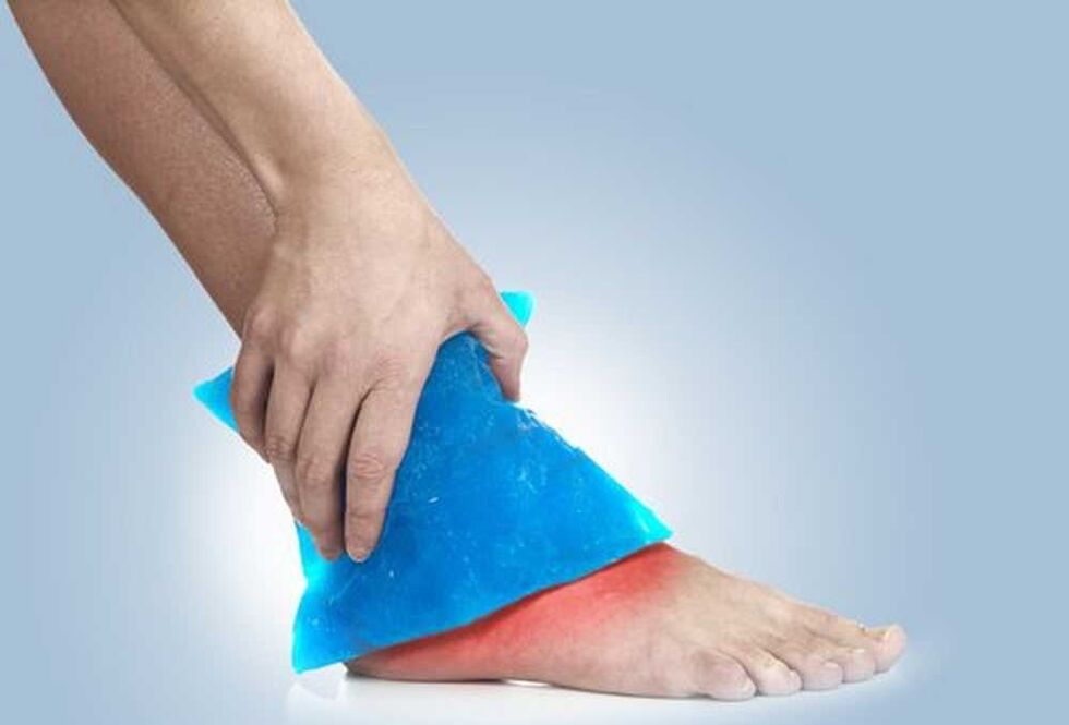 cold bath for ankle arthritis