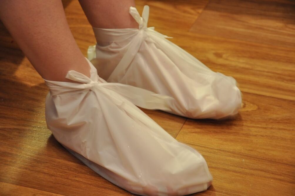 compresses for ankle arthritis