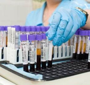 blood test to diagnose joint pain
